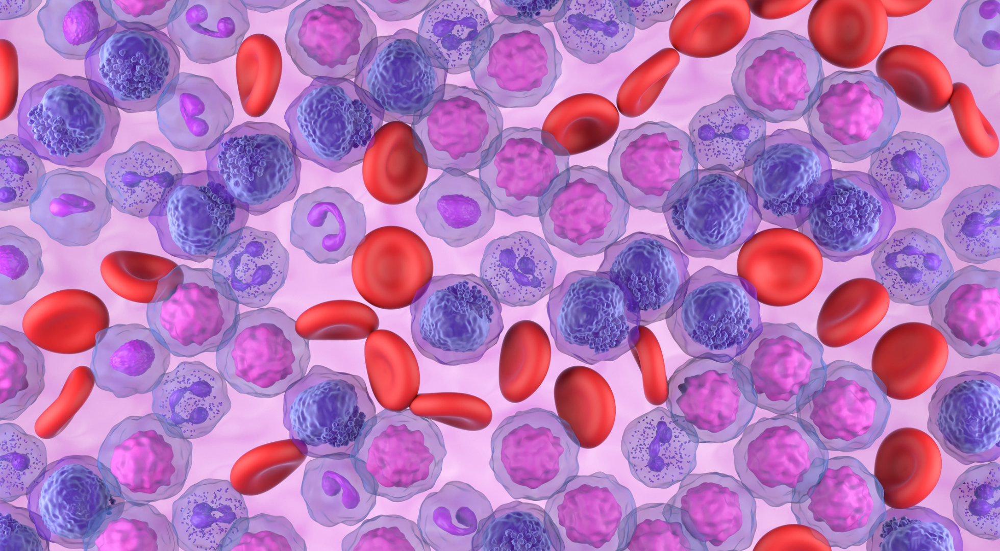 Acute Myeloid Leukemia: Diagnosis, Treatment and Side Effect Management (Nurse Practitioner)